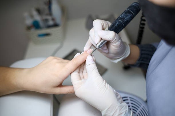 سر سوهان ناخن